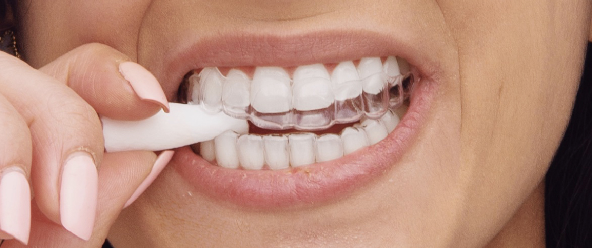What Are Aligner Chewies Used For? The Key Benefits